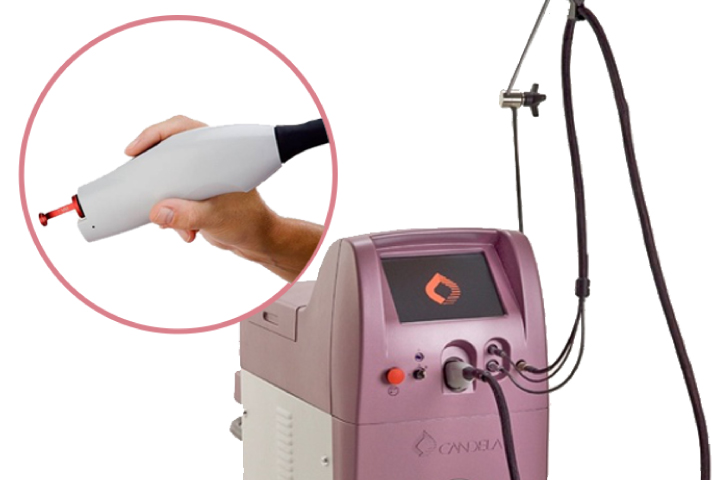 赤ら顔、小鼻の赤み、ニキビ跡