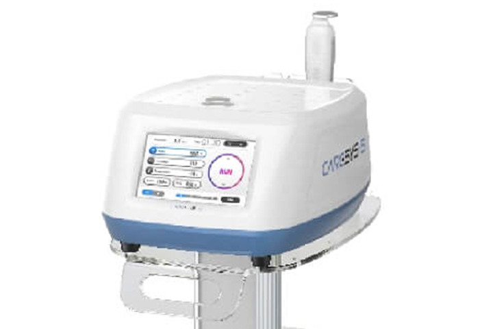 ケアシス(クライオエレクトロポレーション)